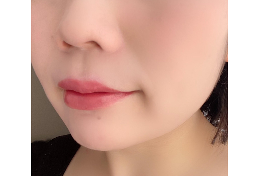 ②